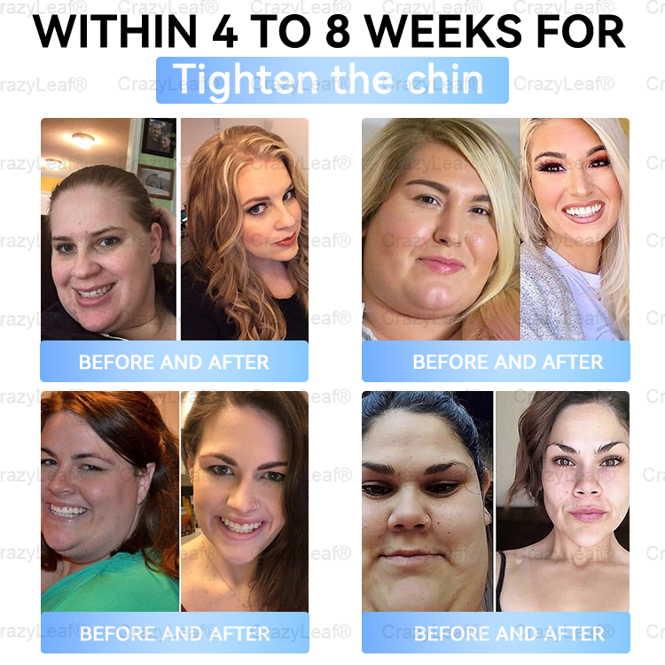 When used together with BuildLeaf® GLP-1 Patch, the effect is boosted by up to 2 times! Purchase now and enjoy a limited-time 70% special discount, helping you achieve your weight loss and health goals faster!