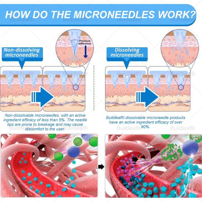 "Last 30 Minutes: Buy One, Get One Free!" Buildleaf® Tirzepatide Nano Microneedle Patch with Collagen & Matrixyl 3000 丨Targets Obesity, Loose Skin, High Blood Pressure, Diabetes, Fatty Liver, Joint Pain, Brain Fog, Low Energy, Body Aches, and More 03