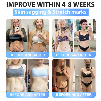 When used together with BuildLeaf® GLP-1 Patch, the effect is boosted by up to 2 times! Purchase now and enjoy a limited-time 70% special discount, helping you achieve your weight loss and health goals faster!