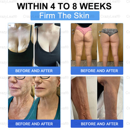 When used together with BuildLeaf® GLP-1 Patch, the effect is boosted by up to 2 times! Purchase now and enjoy a limited-time 70% special discount, helping you achieve your weight loss and health goals faster!