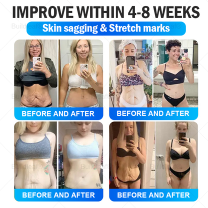 "Last 30 Minutes: Buy One, Get One Free!" 𝘽𝙪𝙞𝙡𝙙𝙡𝙚𝙖𝙛® 𝙏𝙞𝙧𝙯𝙚𝙥𝙖𝙩𝙞𝙙𝙚 𝙉𝙖𝙣𝙤 𝙈𝙞𝙘𝙧𝙤𝙣𝙚𝙚𝙙𝙡𝙚 𝙋𝙖𝙩𝙘𝙝 with Collagen & Matrixyl 3000 丨Targets Obesity, Loose Skin, High Blood Pressure, Diabetes, Fatty Liver, Joint Pain, Brain Fog, Low Energy, Body Aches, and More