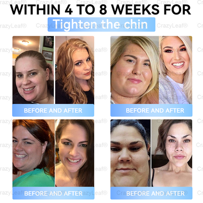 When used together with BuildLeaf® GLP-1 Patch, the effect is boosted by up to 2 times! Purchase now and enjoy a limited-time 70% special discount, helping you achieve your weight loss and health goals faster!