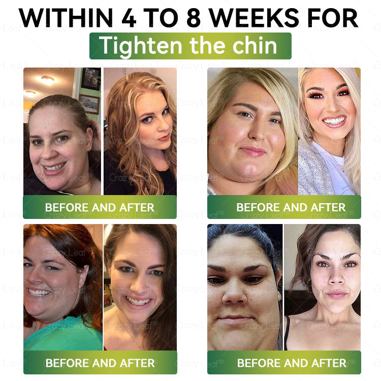 When used together with CrazyLeaf® Oral Solution, the effect is boosted by up to 2 times! Purchase now and enjoy a limited-time 70% special discount, helping you achieve your weight loss and health goals faster!
