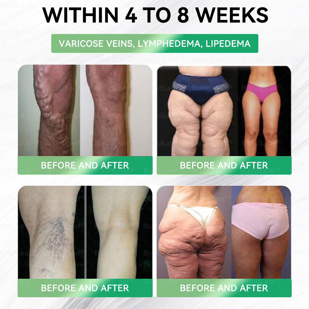 Only 10 Boxes left! We're offering you an additional 30% discount! Get yourself in shape and healthy. Miss out now, and you won't have another chance until next year. BuildLeaf®
