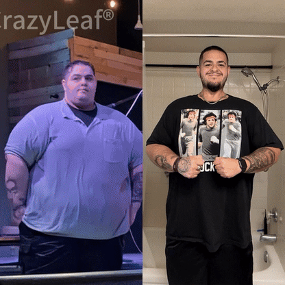 When used together with CrazyLeaf® Oral Solution, the effect is boosted by up to 2 times! Purchase now and enjoy a limited-time 70% special discount, helping you achieve your weight loss and health goals faster!