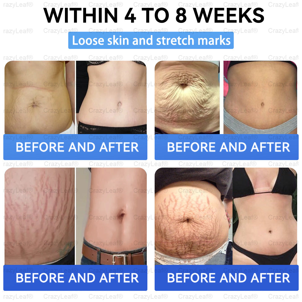 Only 10 Boxes left! We're offering you an additional 40% discount! Get yourself in shape and healthy. Miss out now, and you won't have another chance until next year.CrazyLeaf®