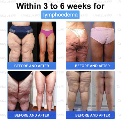 When used together with BuildLeaf® GLP-1 Patch, the effect is boosted by up to 2 times! Purchase now and enjoy a limited-time 70% special discount, helping you achieve your weight loss and health goals faster!